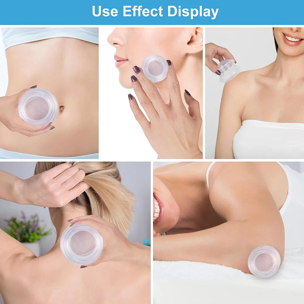  Transparent blue silicone cupping cups for body massage